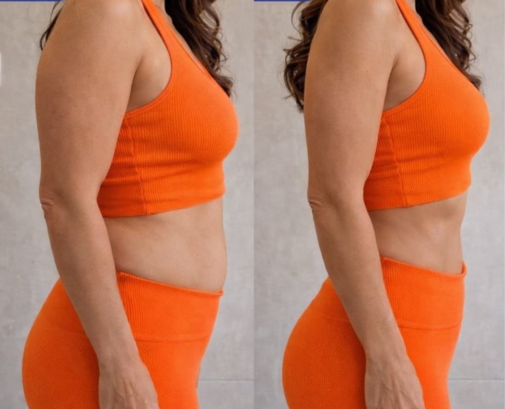 Acelerar o metabolismo